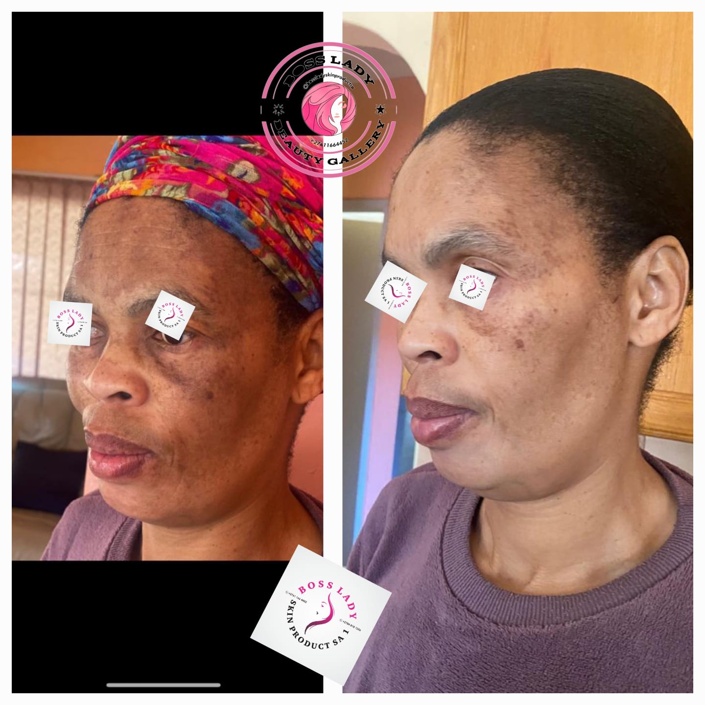 Dark Spot & Pigmentation Care — customer result