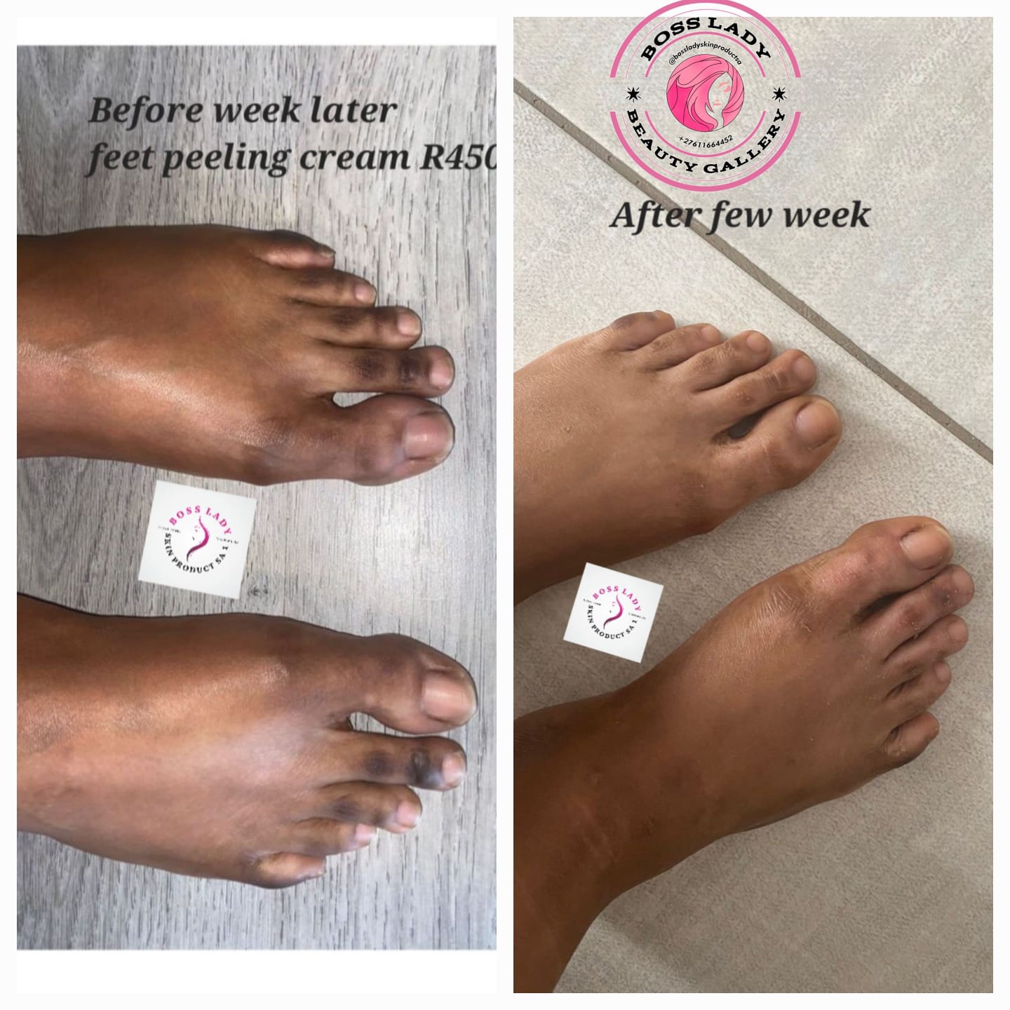Feet Peeling Cream — customer result
