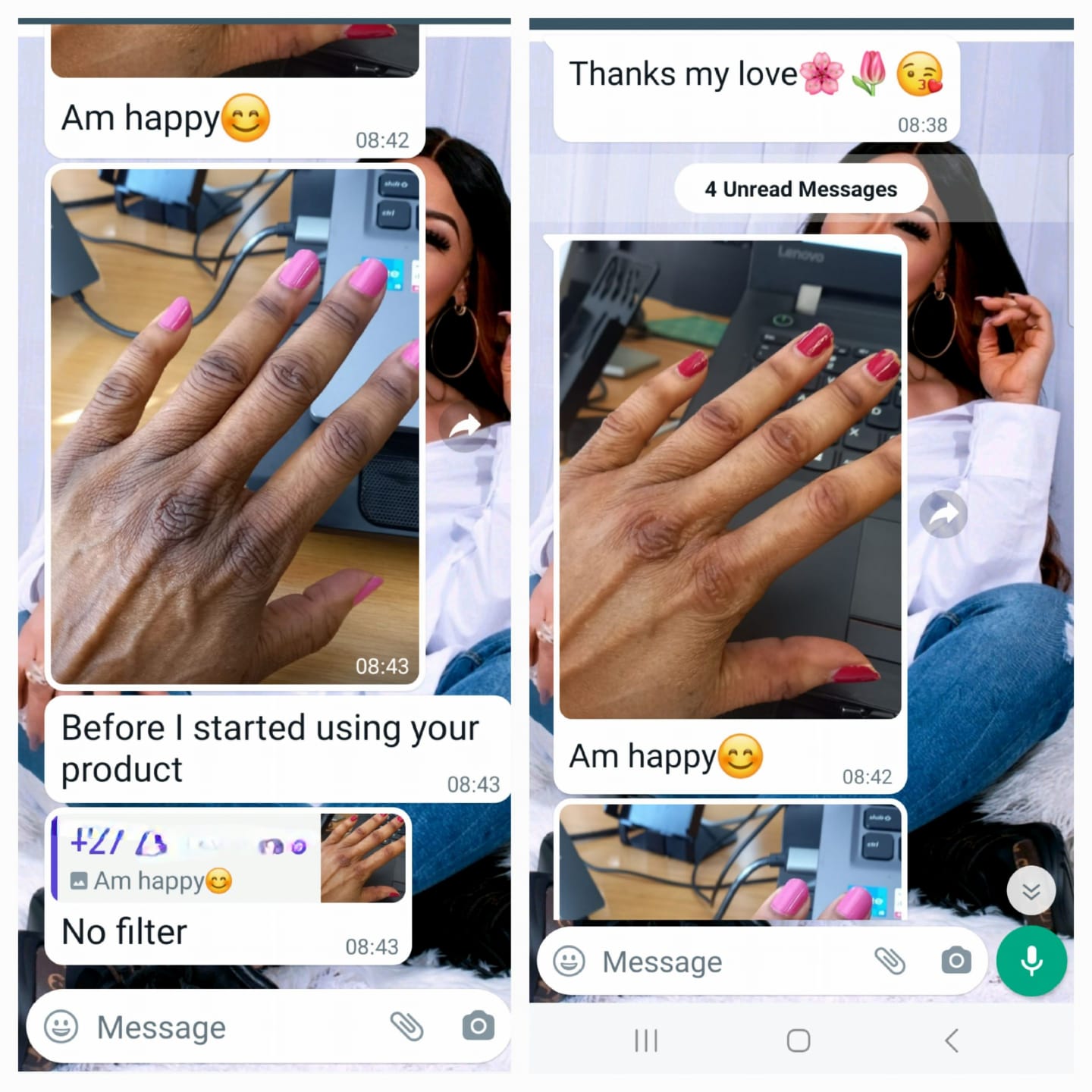 Hand & Knuckle Brightening — customer result